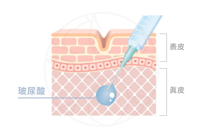 功效2 促進膠原蛋白增生,抗對肌膚衰老