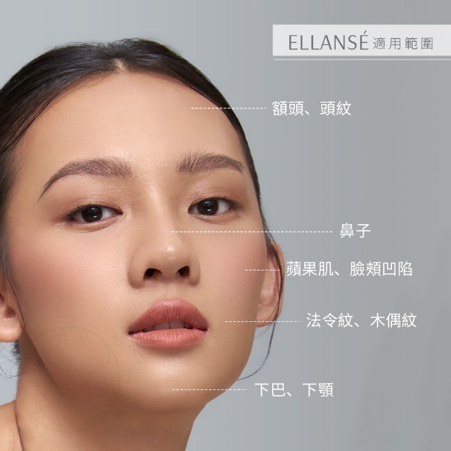 ELLANSÉ 洢蓮絲（少女針）適用範圍包含法令紋,抬頭紋,蘋果肌,下巴,下顎,鼻子