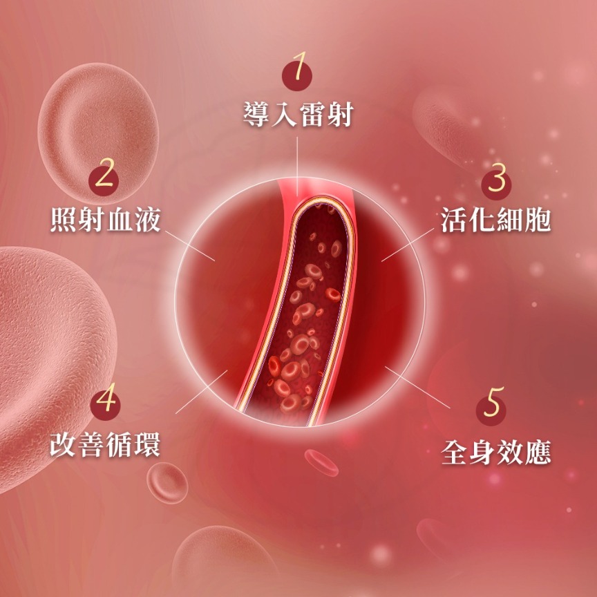 1. 導入雷射 2.照射血液 3.活化細胞 4.改善循環 5.全身效應